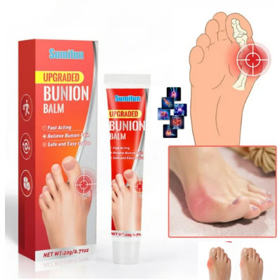 BONION CREMA PARA ALIVIO DE  JUANETES con ENVÍO GRATIS⭐⭐⭐⭐⭐