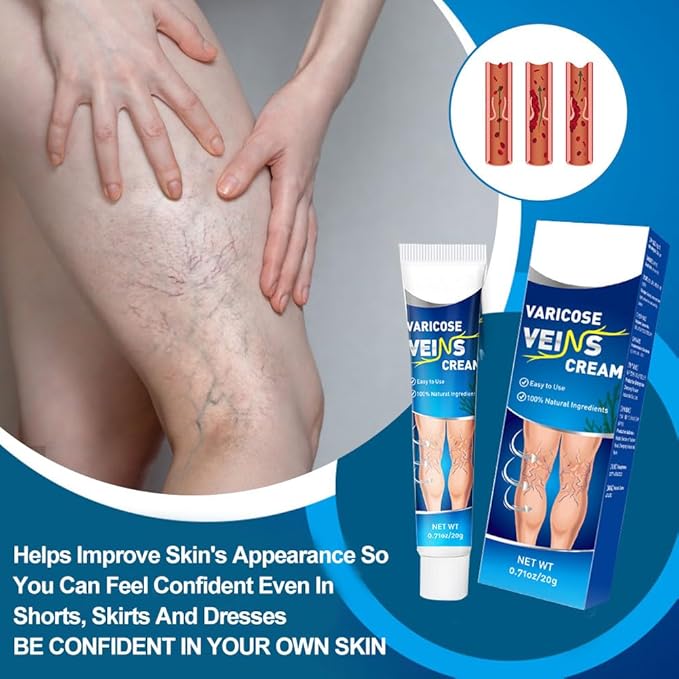 Crema para Varices con ENVÍO GRATIS ⭐⭐⭐⭐⭐