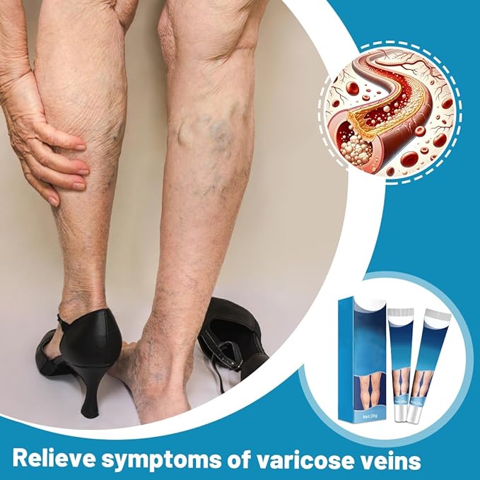Crema para Varices con ENVÍO GRATIS ⭐⭐⭐⭐⭐