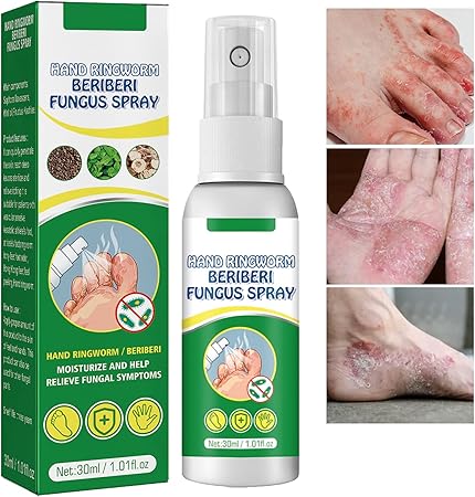 Spray para Hongos Beri con ENVÍO GRATIS ⭐️⭐️⭐️⭐️⭐️