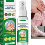 Spray para Hongos Beri con ENVÍO GRATIS ⭐️⭐️⭐️⭐️⭐️