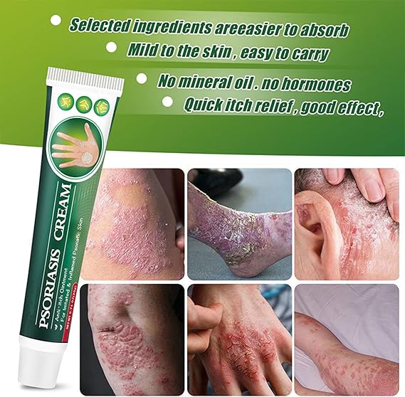 CREMA PSORIASIS UNGENTO con ENVÍO GRATIS ⭐️⭐️⭐️⭐️⭐️