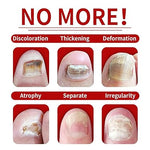 Tratamiento hongos uñas con  ENVÍO GRATIS⭐️ ⭐️ ⭐️ ⭐️ ⭐️