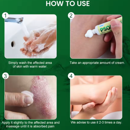 CREMA PSORIASIS UNGENTO con ENVÍO GRATIS ⭐️⭐️⭐️⭐️⭐️