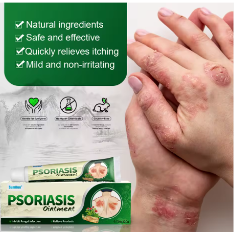 CREMA PSORIASIS UNGENTO con ENVÍO GRATIS ⭐️⭐️⭐️⭐️⭐️
