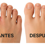 Spray para Hongos Beri con ENVÍO GRATIS ⭐️⭐️⭐️⭐️⭐️